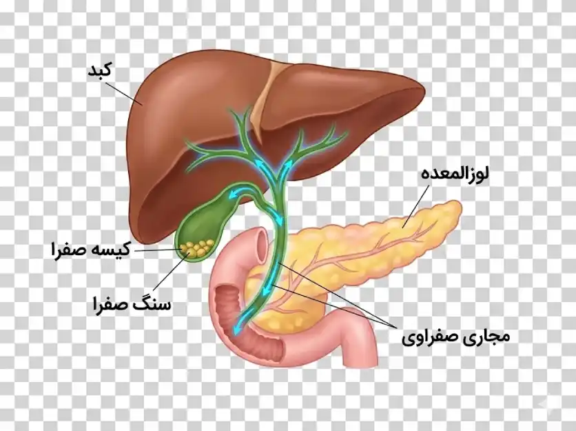 آناتومی کبد، کیسه صفرا دارای سنگ، لوزالمعده و مجاری صفراوی